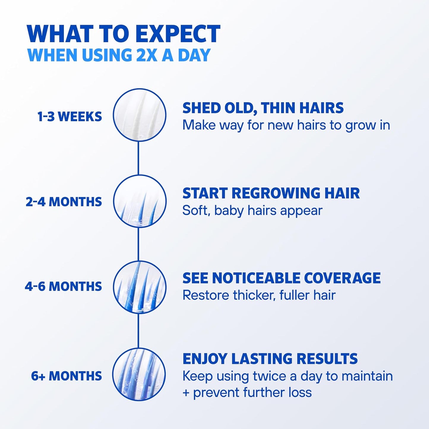 Men's Rogaine Extra Strength 5% Minoxidil Solution - 3-Month Supply | 3 x 2 Fl Oz Bottles