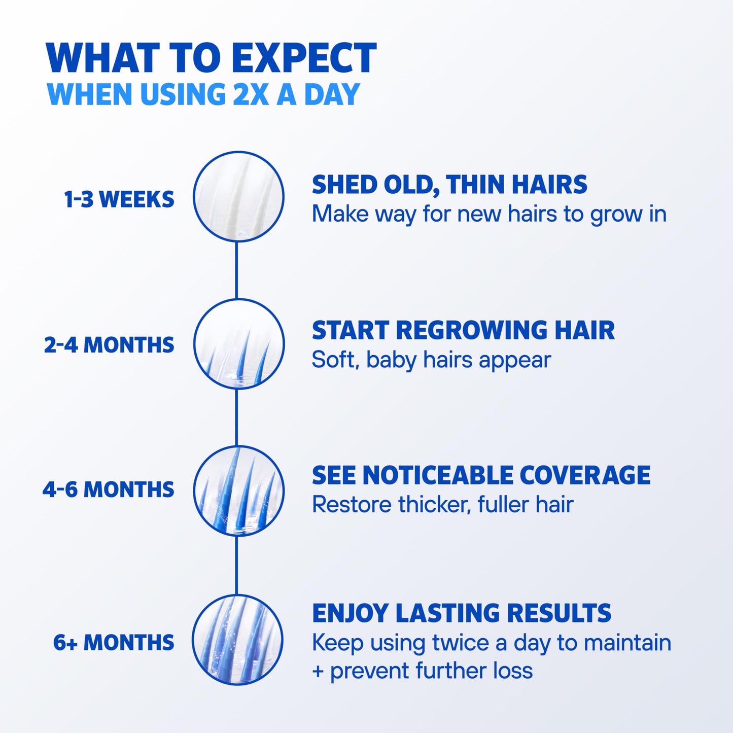 Men's Rogaine 5% Minoxidil Foam for Hair Regrowth, Topical Hair Loss Treatment for Men to Regrow Fuller, Thicker Hair, Unscented Minoxidil Topical Aerosol, 1-Month Supply, 2.11 oz