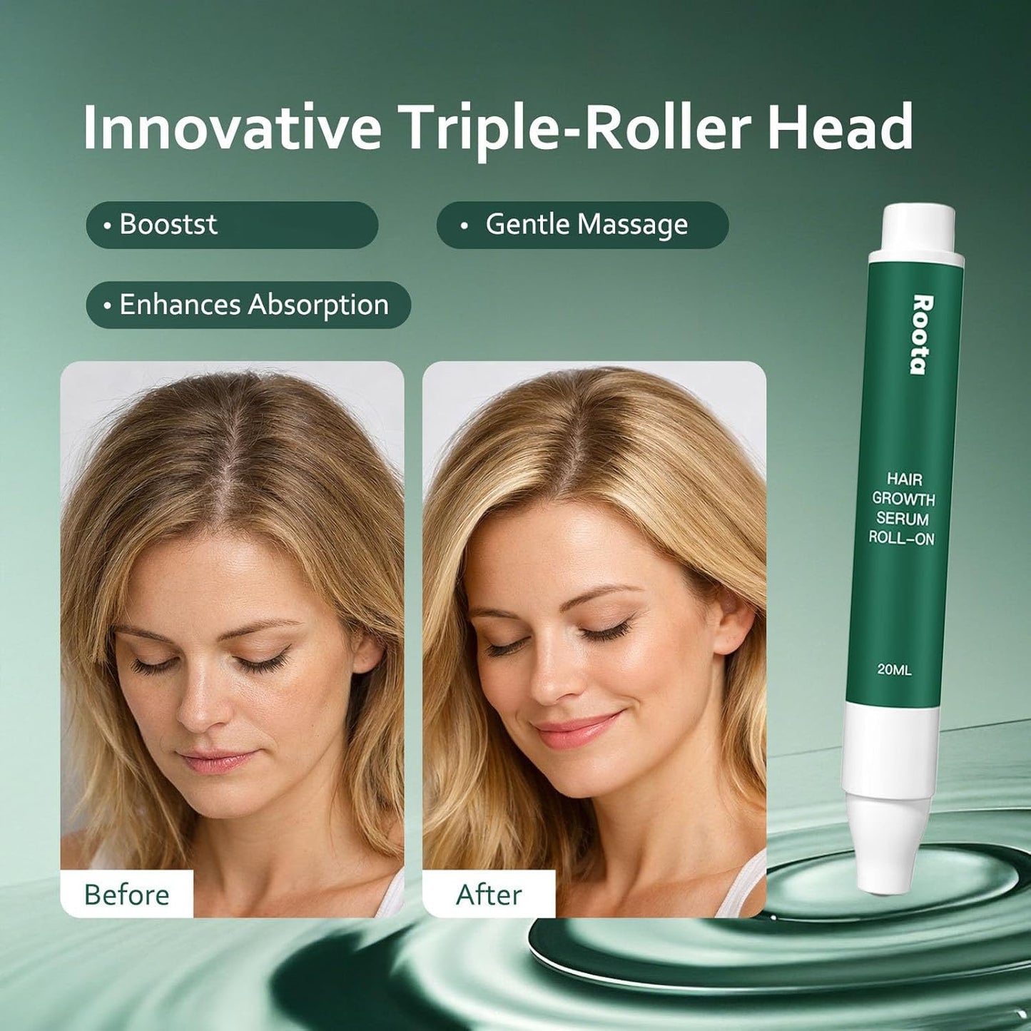 Hair Growth Serum Roll-On | Nourishing Scalp Treatment for Thicker, Healthy Hair - 20ml/0.68 fl oz