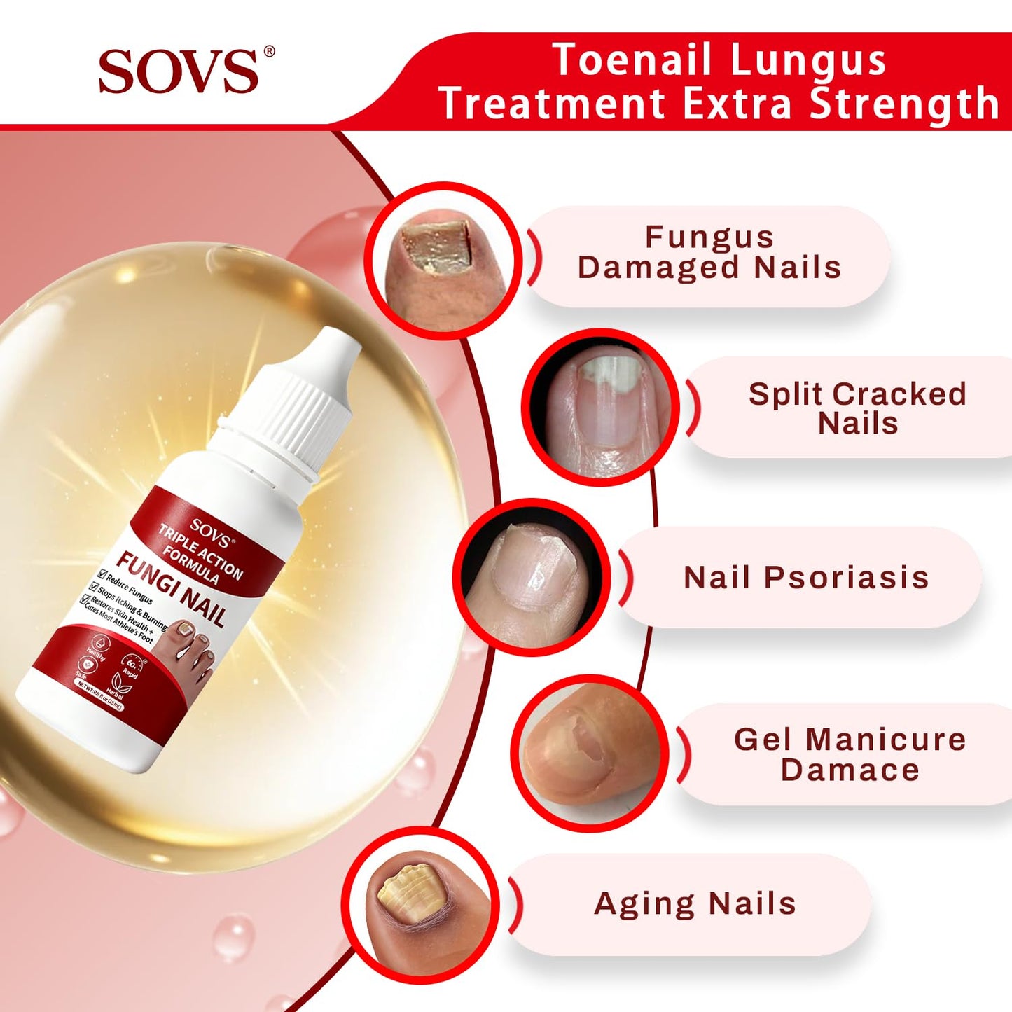 Toenail Treatment - Gentle Formula for Healthy Nails | 1 Piece