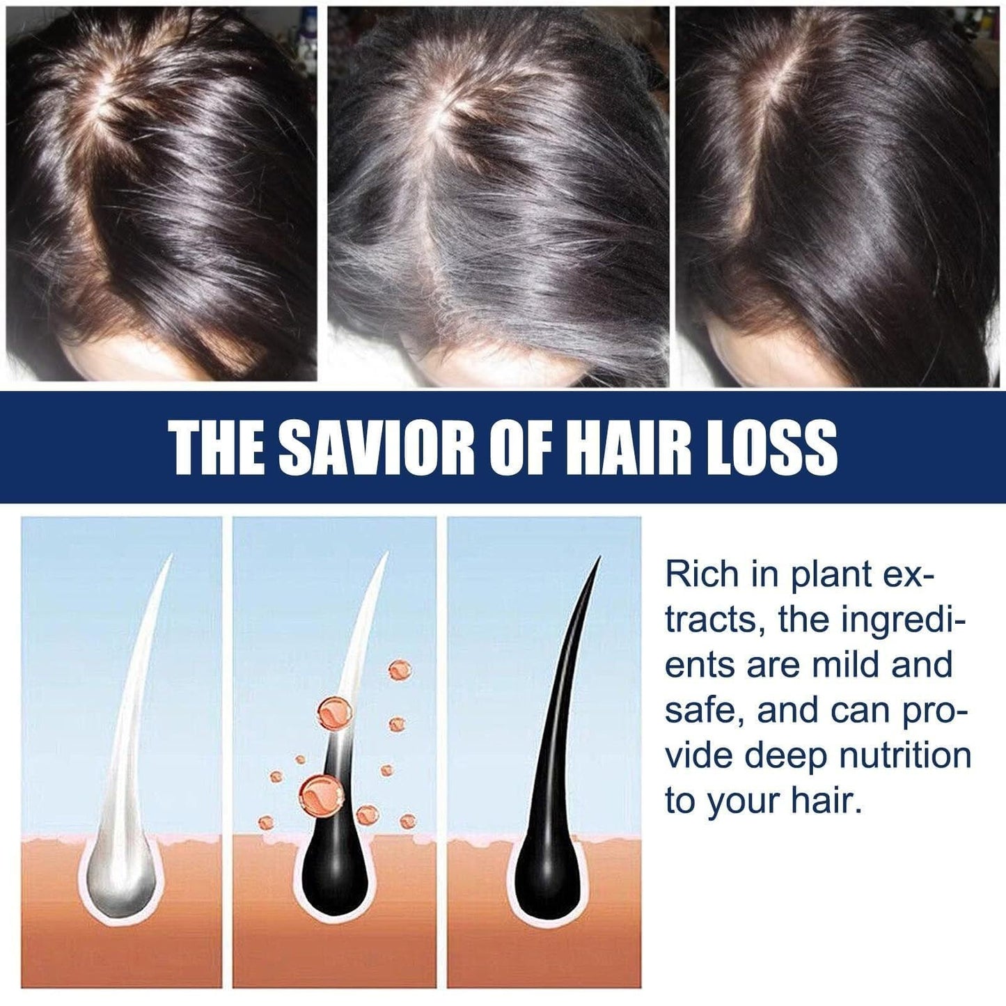 Alopecia Hair Products Suitable for Men & Women