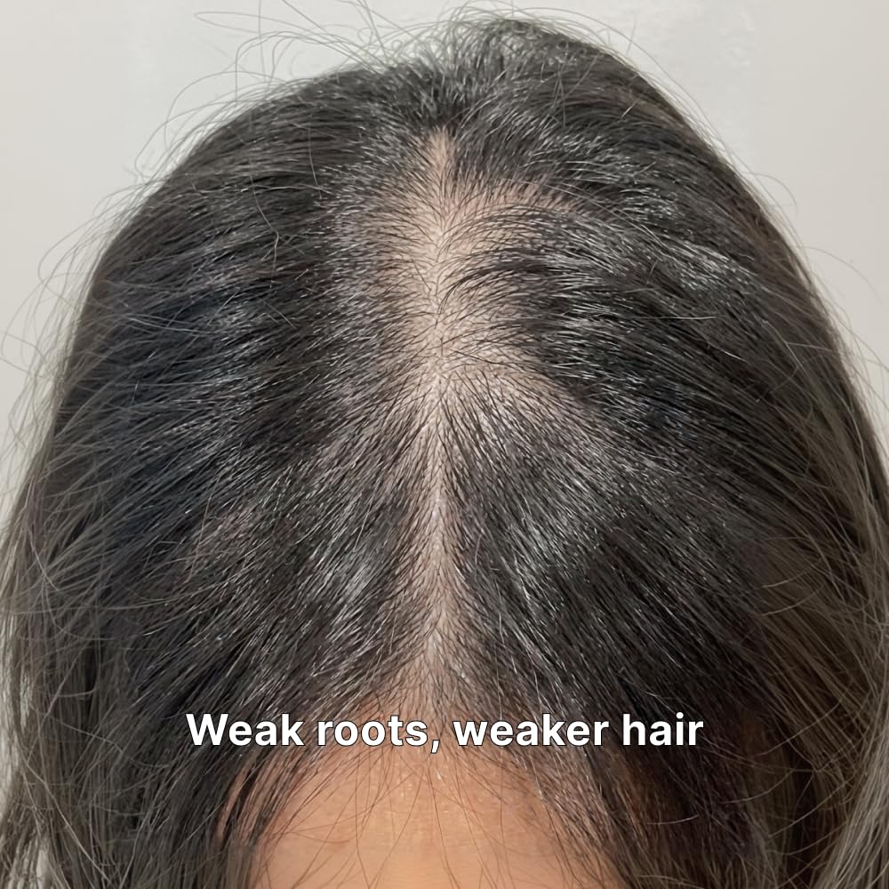 Black Grain Strengthening Shampoo for Thinning Hair - Reduces Breakage & Enhances Scalp Health | 16.9 fl oz / 500ml