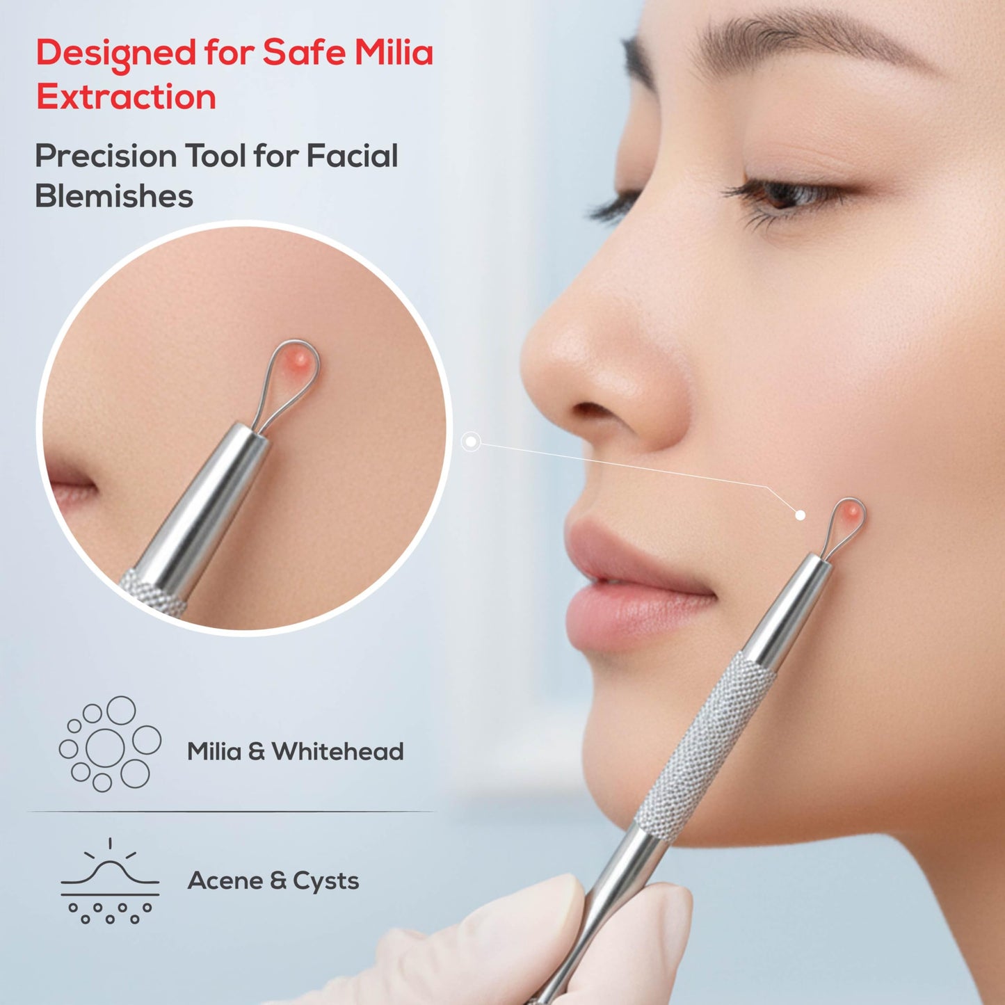 Suvorna Pimple Popper Tool Kit & Milia Remover, 4-Piece Stainless Steel Blackhead Extractor, Whitehead & Comedone Extractor with Lancets for Facial Extraction