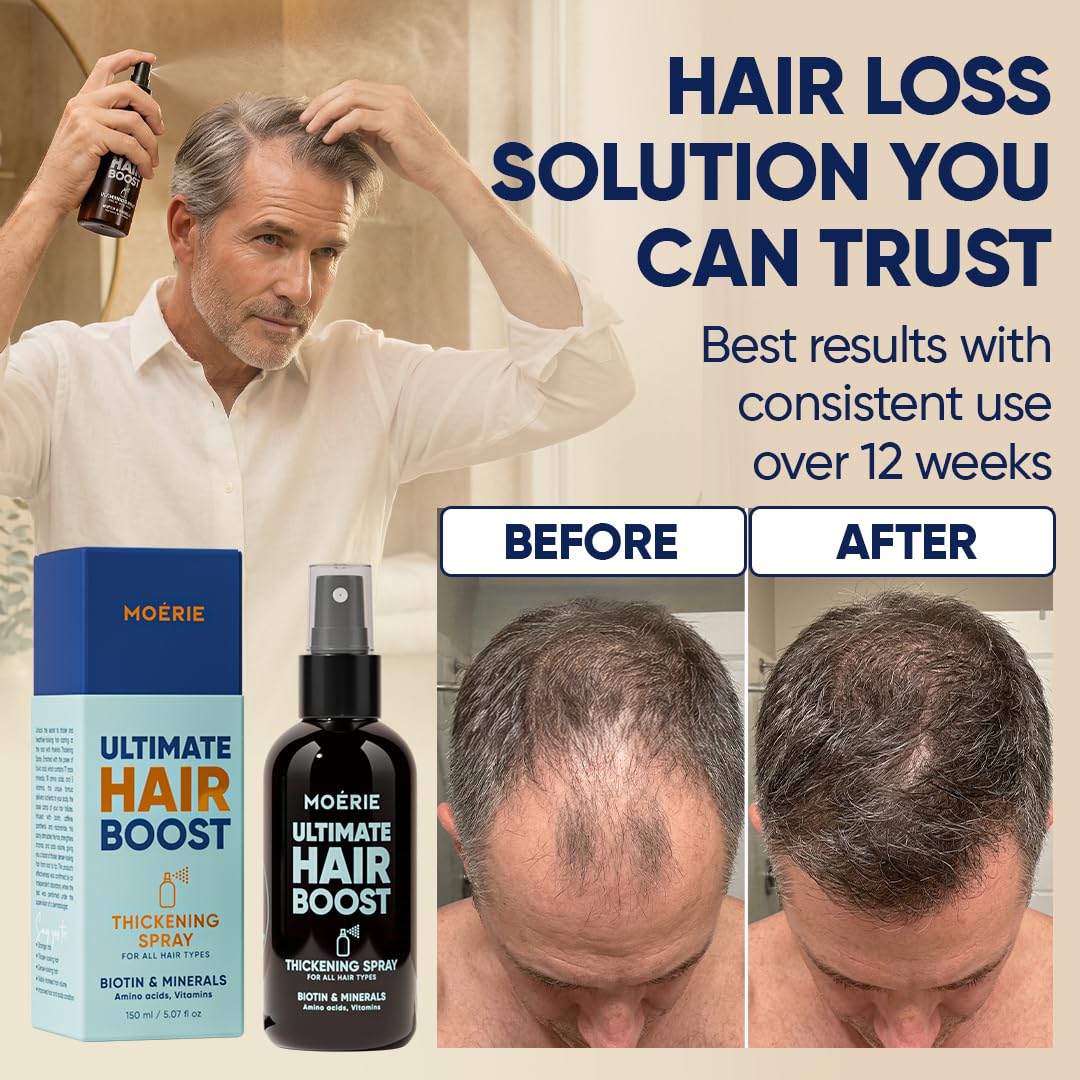 Moerie Hair Growth Serum Spray - Biotin & Rosemary Formula for Thinning Hair | Scalp Care & Regrowth Solution