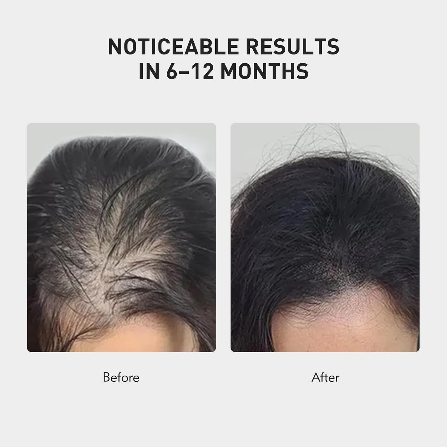 KX-826 KINTOR Hair Growth Spray - Nourishing Formula for Thinning Hair | 60ml