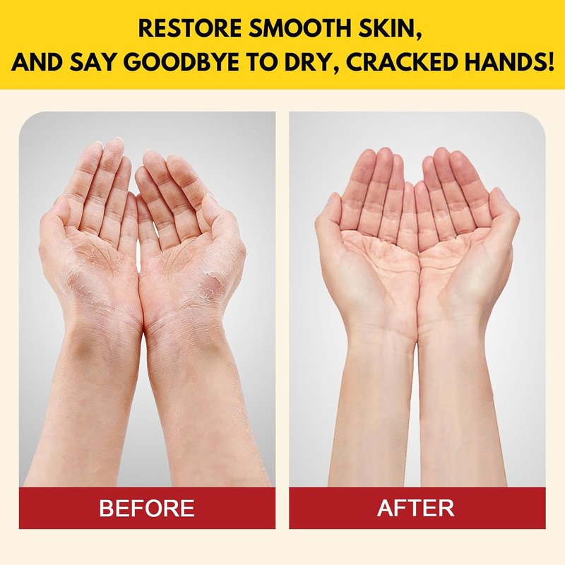 Hand Cream for Dry Cracked Hands - 3-Pack Moisturizing Balm with Lanolin | Fragrance-Free, Non-Greasy, 3.53 oz