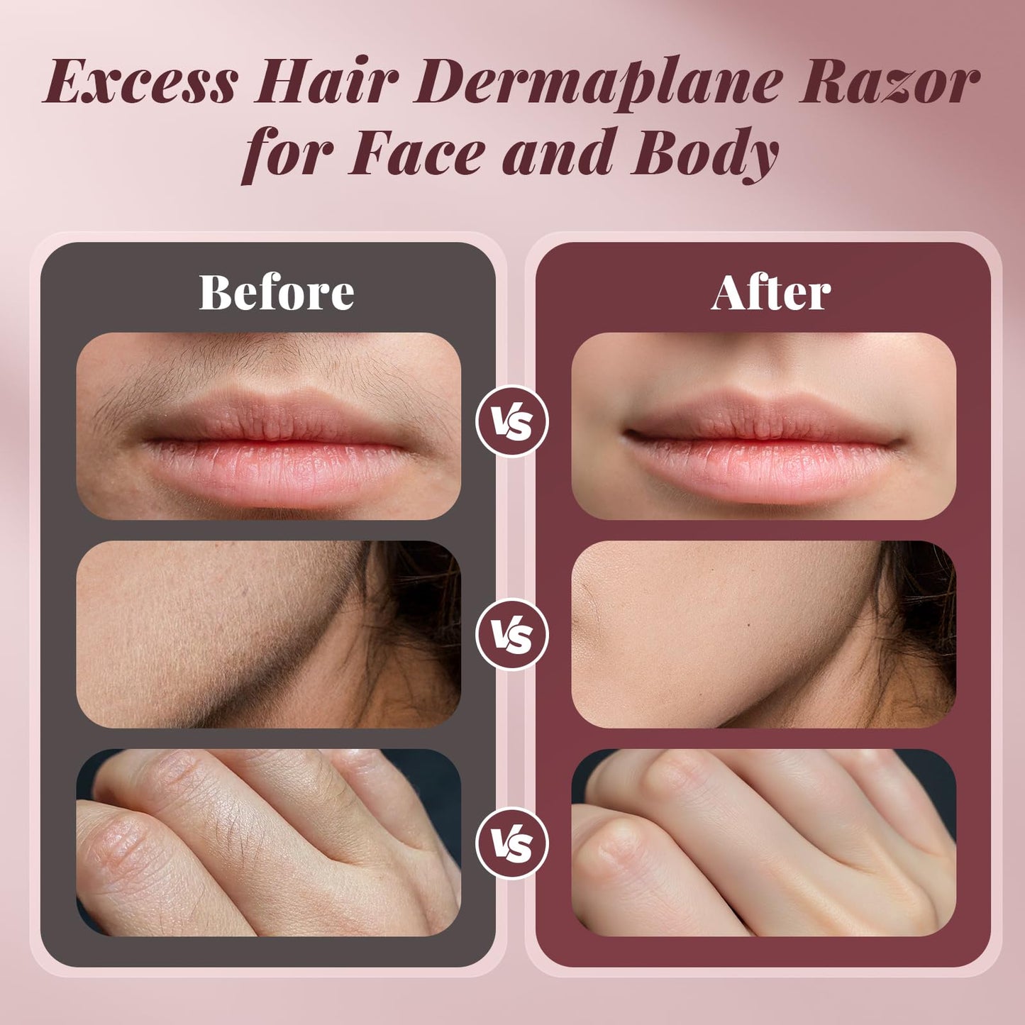 Dermaplane Razor for Women Face, BNU Facial Hair Remover for Anti-Aging, Rechargeable, LED Light, Sonic Edges, 3 Speeds, Ergonomic Handle Face Dermaplaning Tool 10 Blades Pink