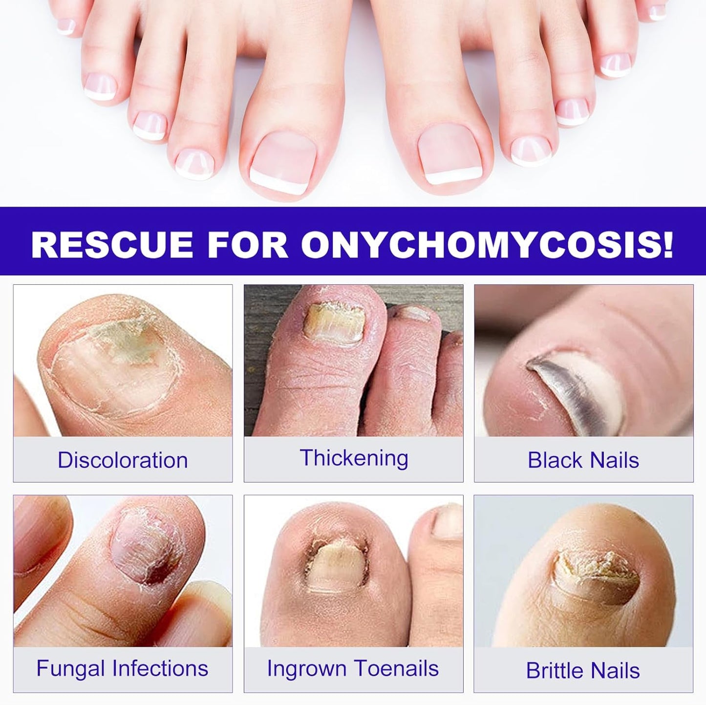 Toenail Fungus Treatment - Extra Strength Fungal Nail Patches | 24 Pcs for Overnight Repair & Care
