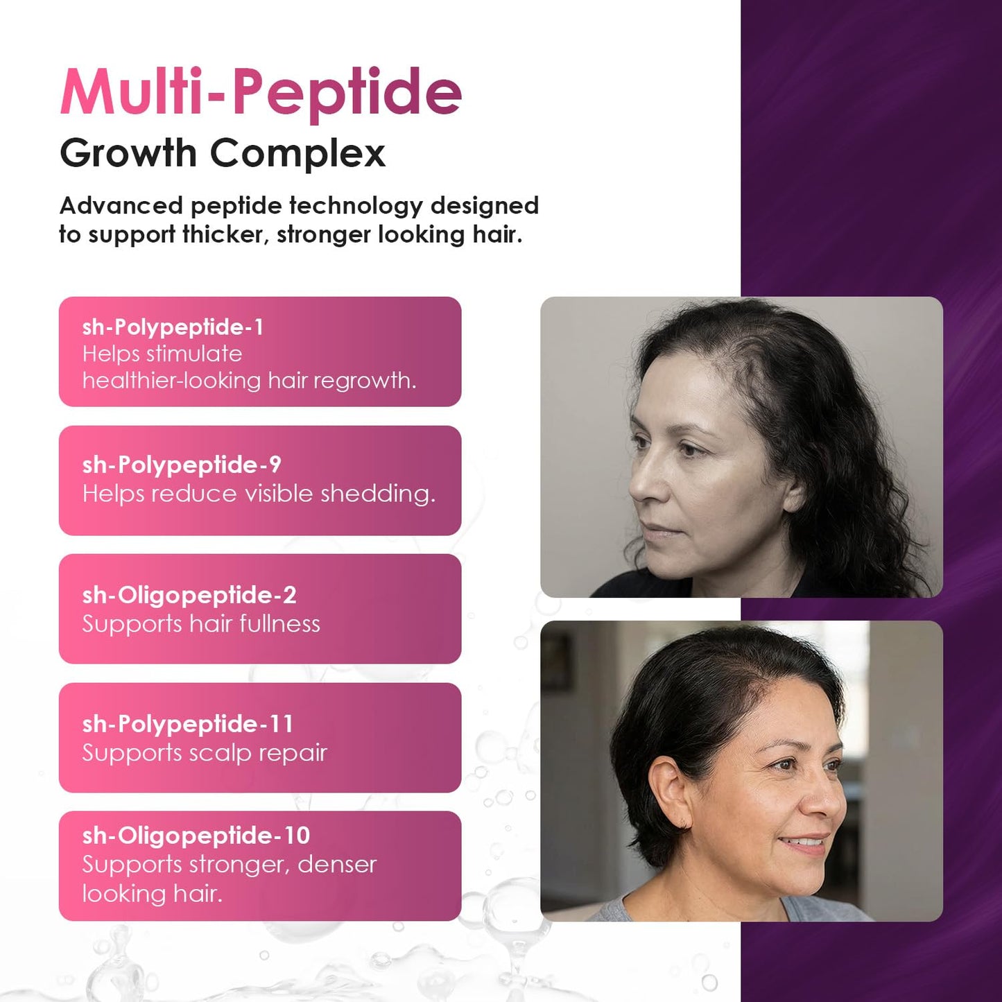 Hair Magic™ Hair Growth Serum - Multi-Peptide & Rosemary Oil Treatment for Hair, Beard, Eyebrows | Unisex Scalp Solution