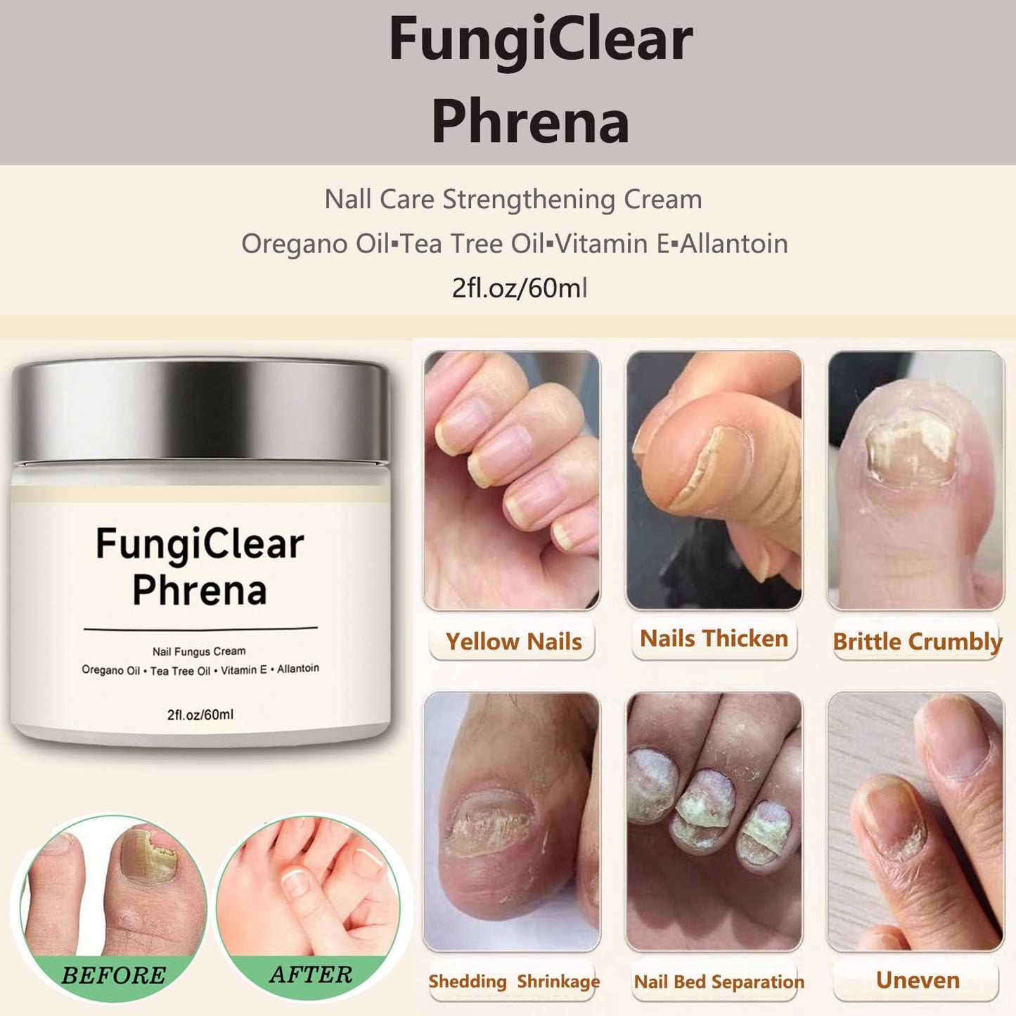 FungiClear Phrena Nail Care Cream,Toenail Nail Repair for Damaged, Strength & Nail Growth Tea Tree Oil, Oregano Oil, Vitamin E 60ml,2.03fl.oz (1pcs)