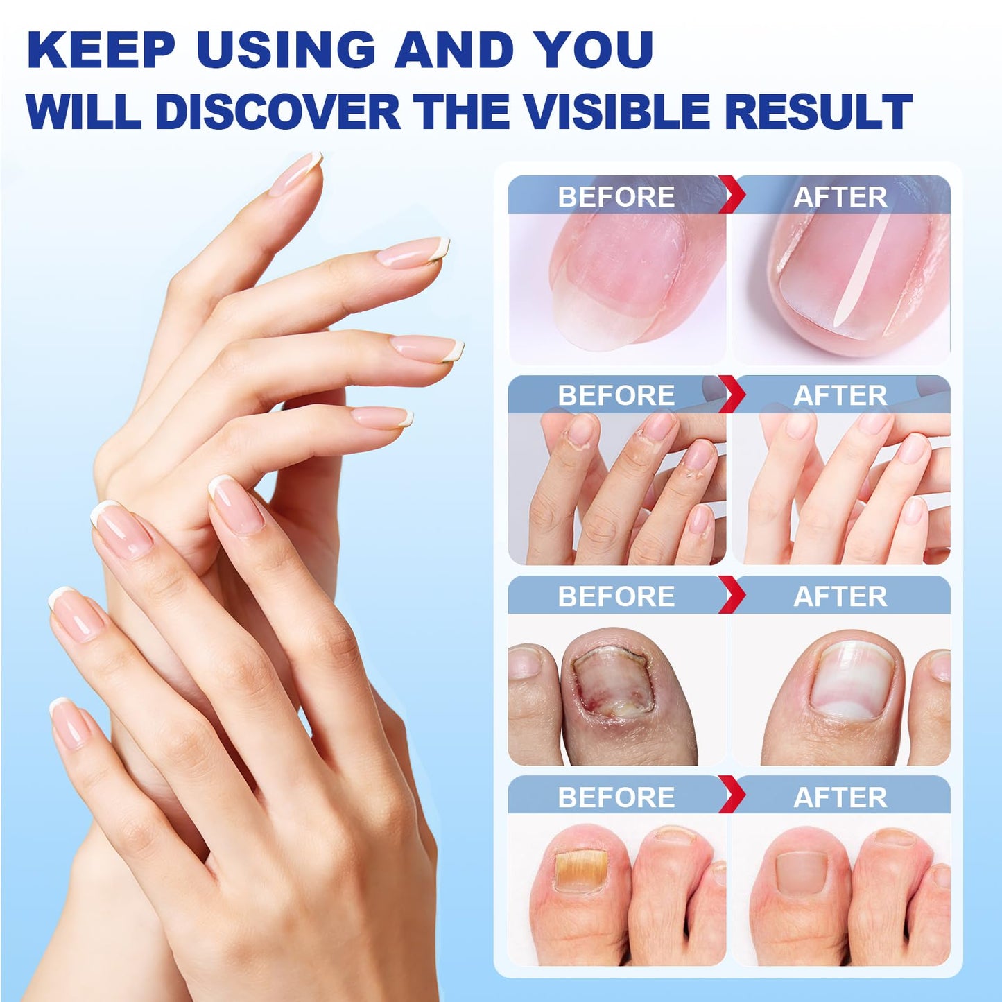 Nail Patches 42 Count, Extra Strength 8-Hour Overnight Fast Nail Care Patches, Nails Patch for toenails Fits Large and Small Nails for Men and Women
