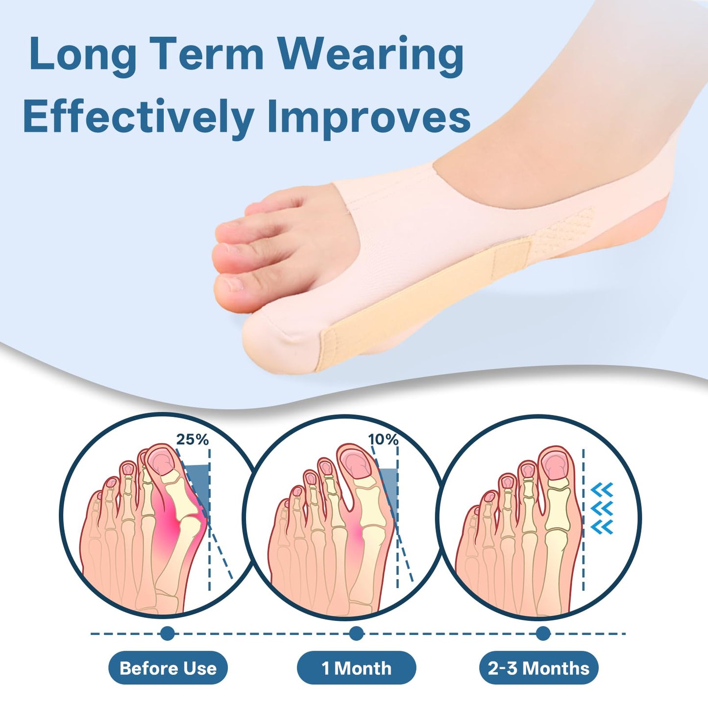Kyuijctan Adjustable Bunion Corrector for Women & Men, Soft and Confortable Big Toe Straightener, Fits in Shoes & Socks for Pain Relief and Hallux Valgus, Designed for Day & Night Wear(1 Pair,M)