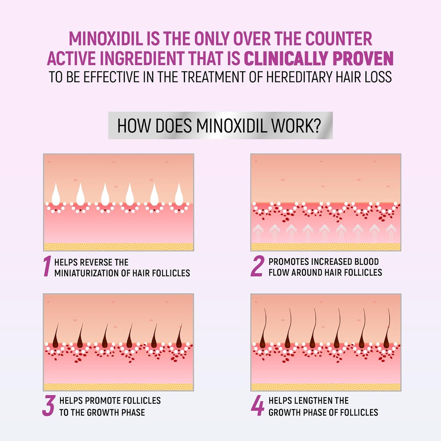Minoxidil for Women - 5% Hair Regrowth Foam | Clinically Proven, 2.11 Oz (2-Month Supply)