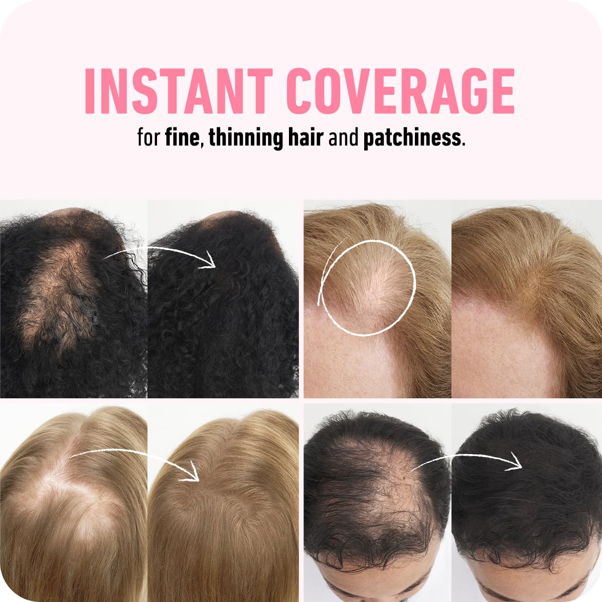BOLDIFY Hair Fibers - Thinning Hair Solution for Instant Volume | 14 Shades Available - Dark Auburn (56g)