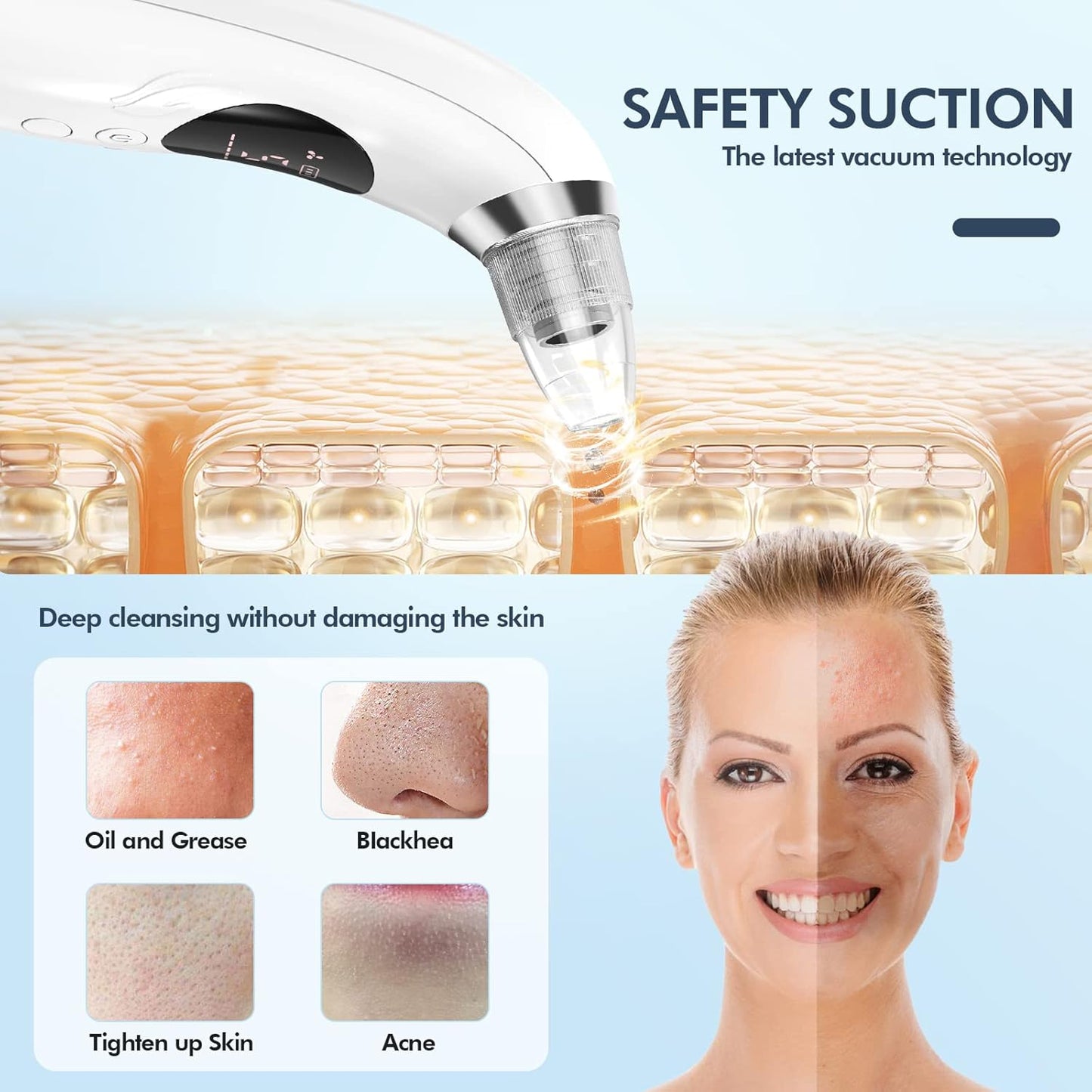 Blackhead Remover Vacuum - Electric Pore Cleaner with 5 Suction Levels & Probes | USB Rechargeable Acne Tool Kit