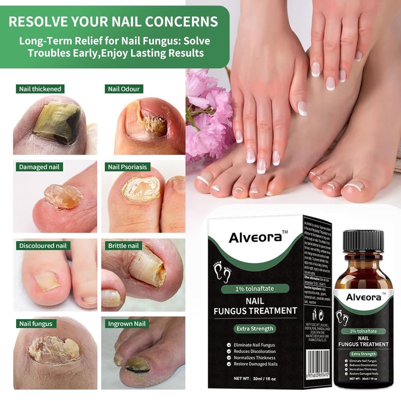 Toenail Fungus Treatment - Extra Strength Fast Acting Repair for Yellow, Thick, Discolored Nails | 1 Fl Oz (30ml)
