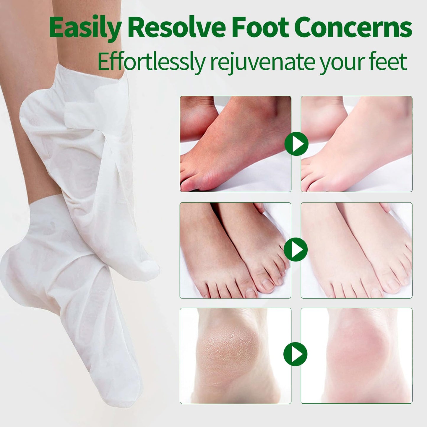 5 Pack Moisturizing Foot Mask, Hydrating Feet Mask for Dry Cracked Feet, Moisturizing Foot Socks Dry Skin Moisturizer for Soft Smooth Feet, Foot Spa Care Kit, Ideal Holiday Gift for Women and Men