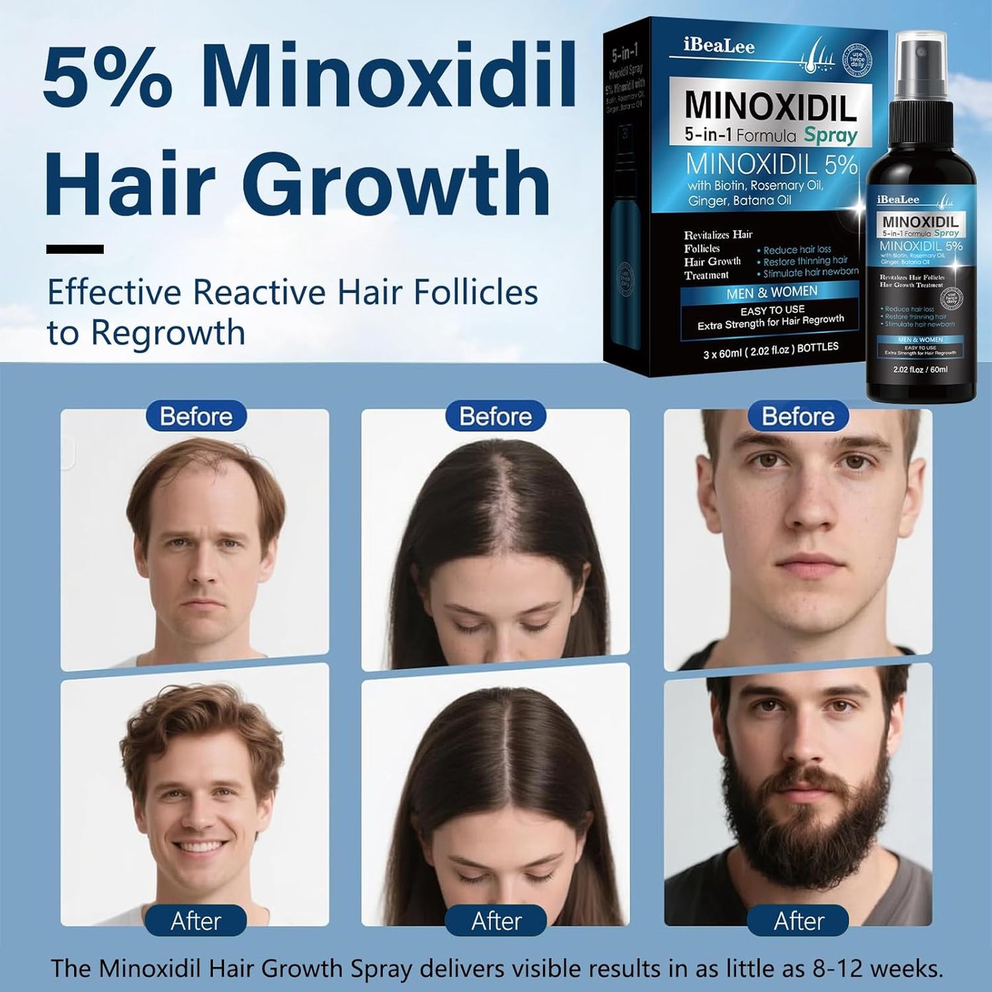 Minoxidil Hair Growth Serum for Men & Women - Biotin & Rosemary Formula | 3 Bottles for Thicker, Fuller Hair