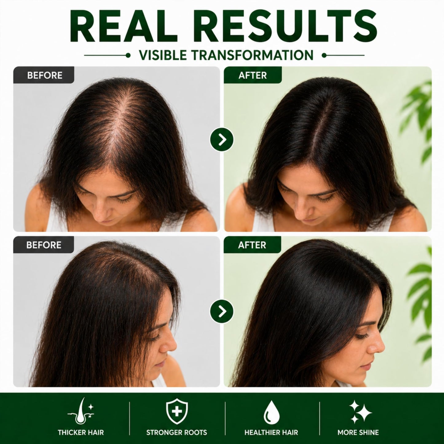 Kachita Spell Strong Growth Hair Care Set – Shampoo, Hair Mask & Serum with Biotin, Rosemary, Onion & Ginger – Anti-Thinning Hair Routine for Fuller, Stronger-Looking Hair, For Men & Women