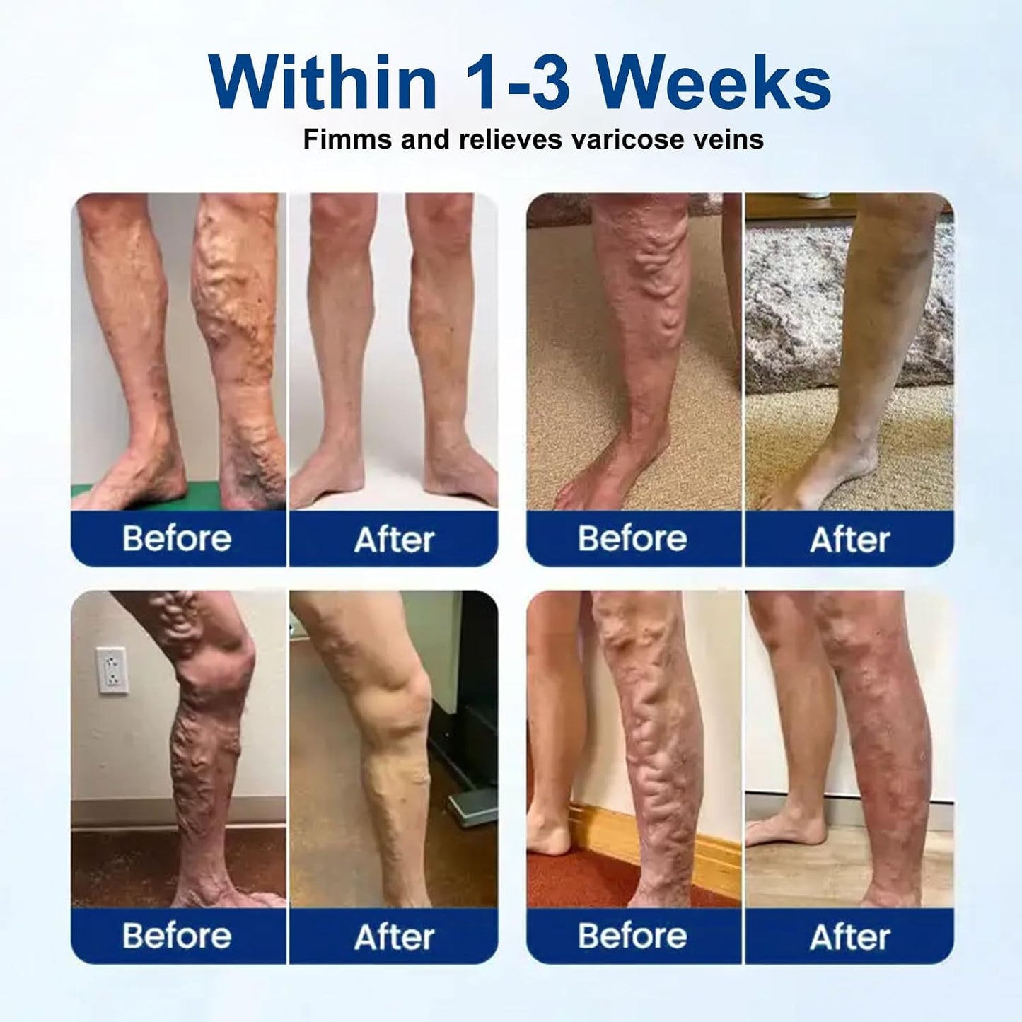 Moon Rind VeinTarget Microdarts Patch - Professional Varicose Veins Treatment for Legs | Natural Ingredients, 3 Pcs
