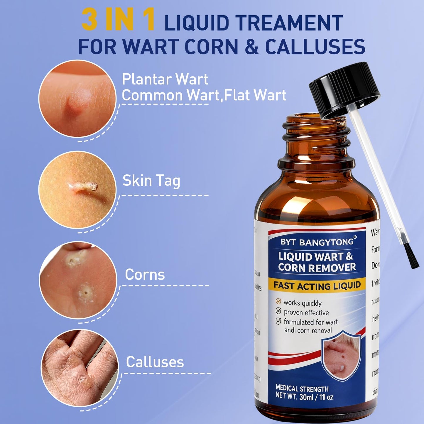BYT BANGYTONG Wart Remover Liquid - Gentle Formula for Plantar Warts, Common & Corn on Feet, Hands and Other External Areas - 17% Salicylic Acid - NET WT: 30ml/ 1fl oz