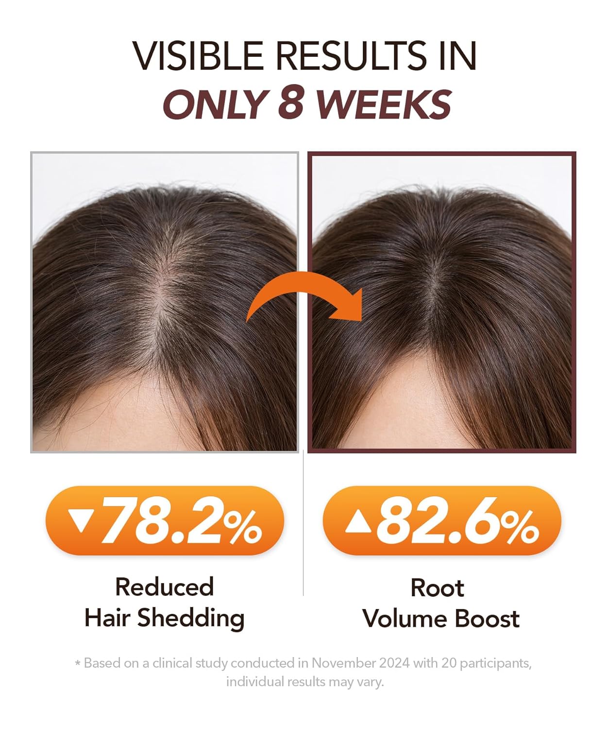 Hair Boosting Ampoule Tonic - Scalp Serum for Fine & Thinning Hair | Lightweight TrinogeniX Formula (1.69 fl. oz.)