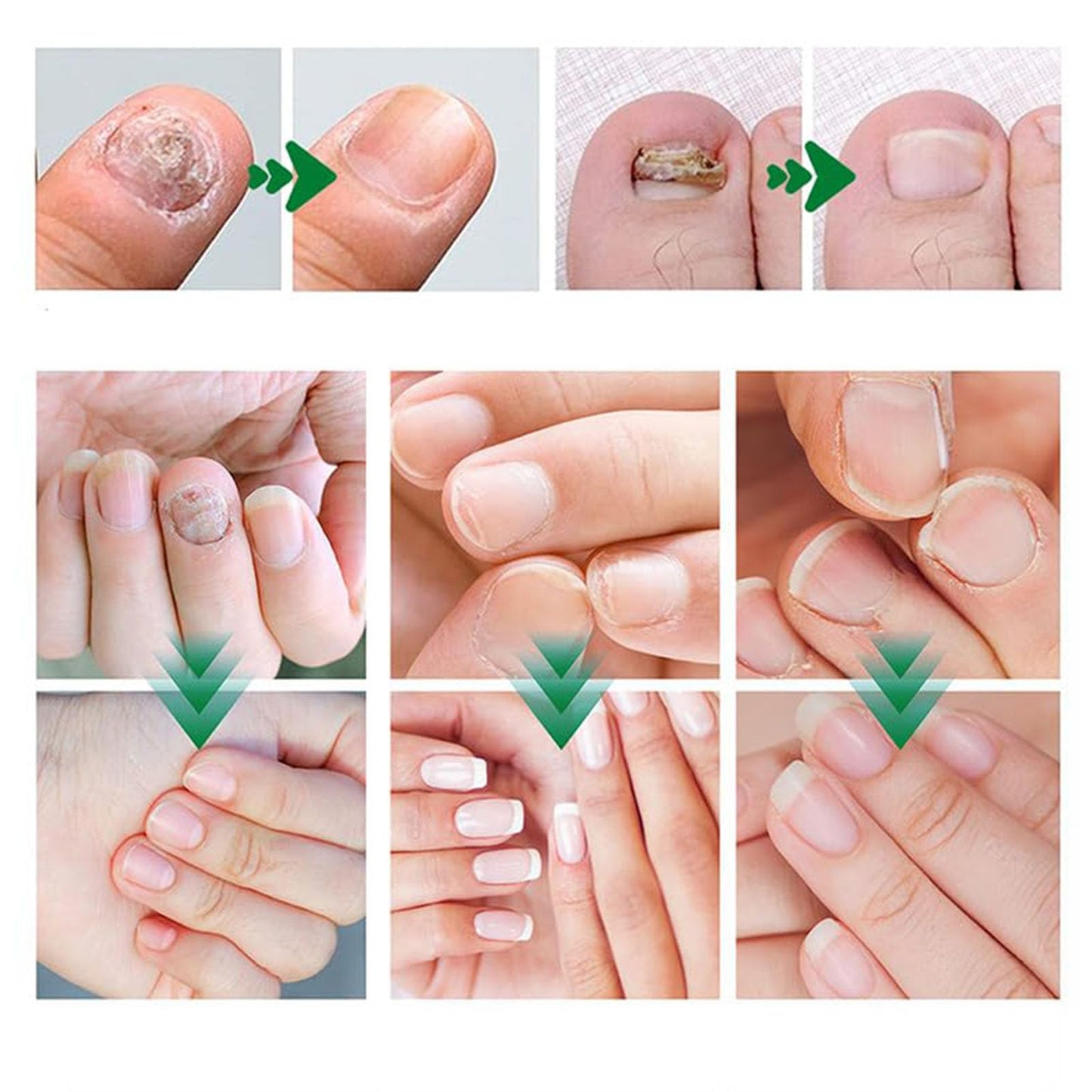 Nail Treatment Gel, Nail Growth Serum for Repair & Strengthener