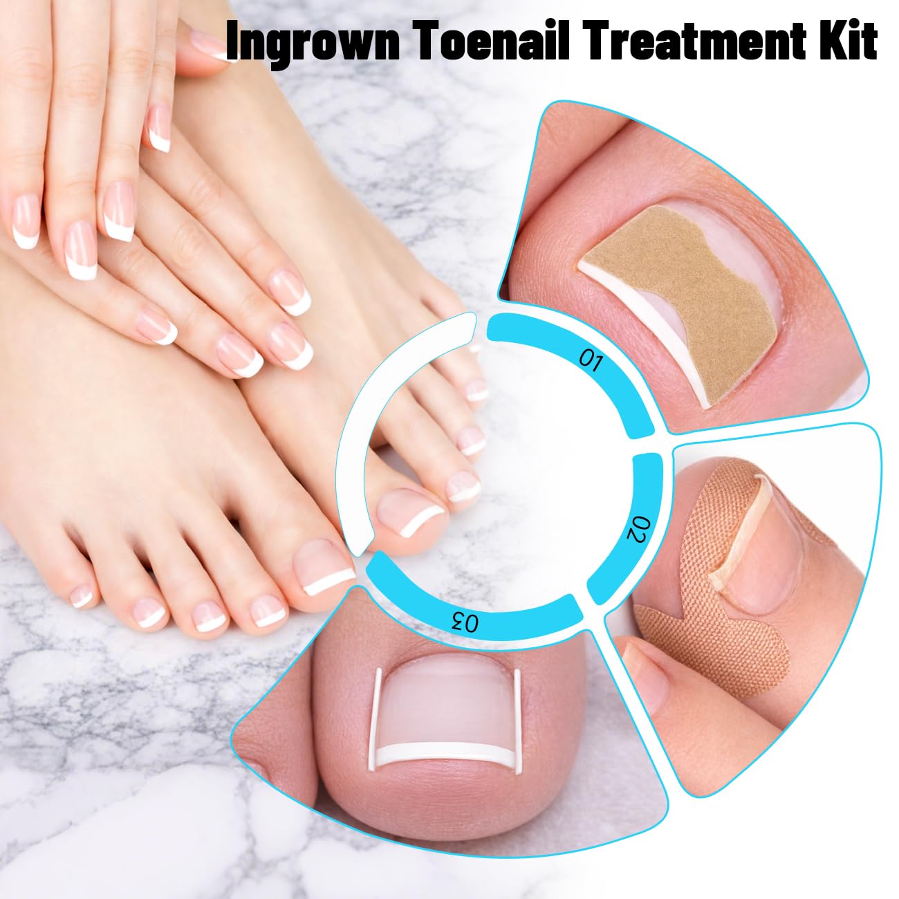 2026 Upgraded Ingrown Toenail Removal Kit, Ingrown Toenail Treatment, Stainless Steel Ingrown Toenail Corrector, Surgery Grade Ingrown Toenail Tool Tool By Dualeco