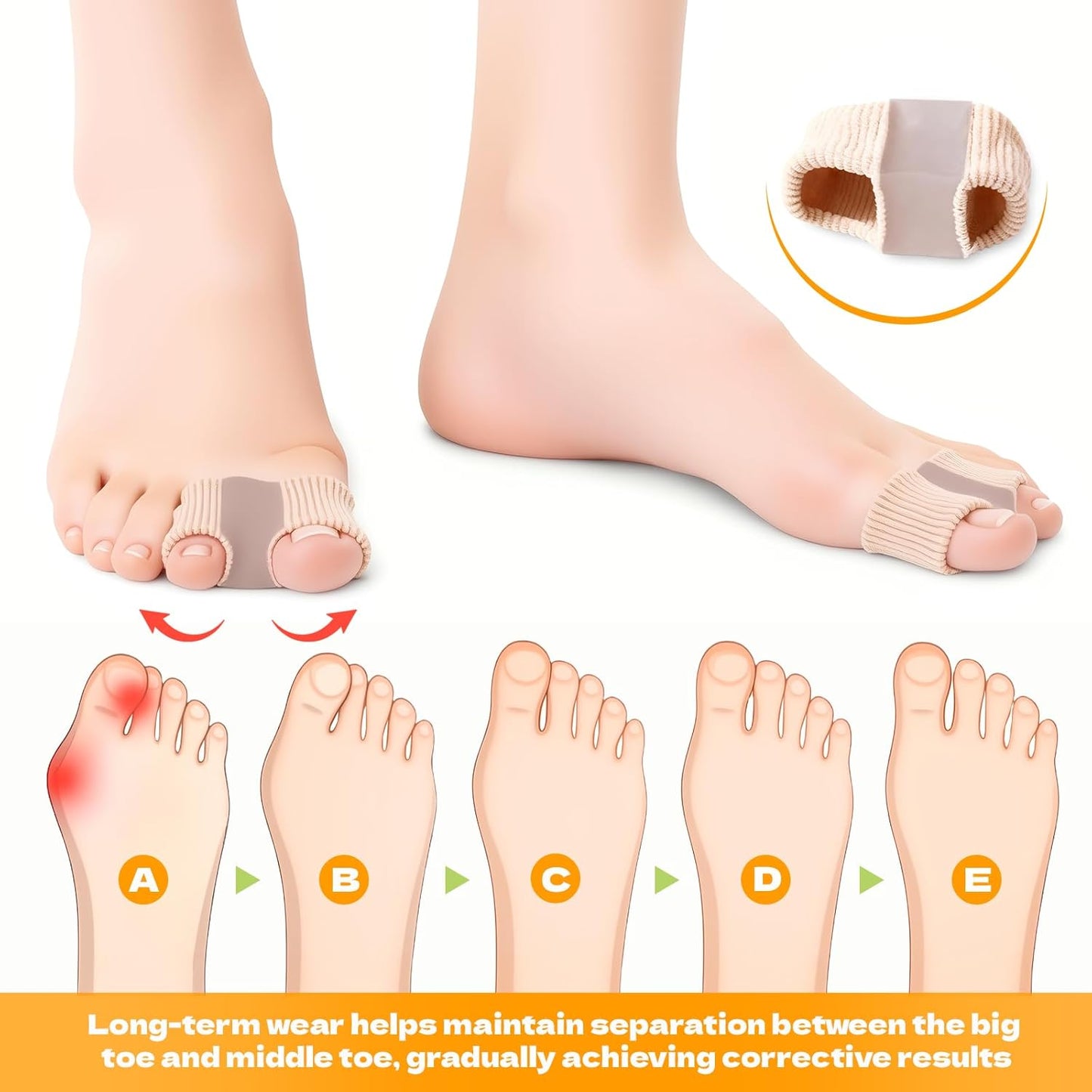 Toe Spacers - 4 PCS Toe Separators for Overlapping Toes | Bunion Corrector & Hammer Toe Straightener