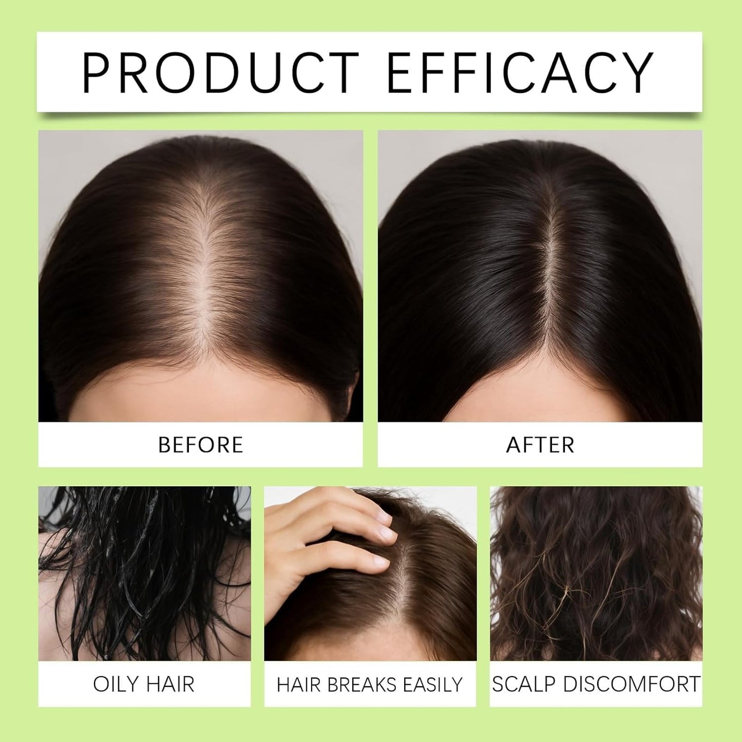 Hair Regrowth System - Advanced Ginseng & Peppermint Oil Formula for Fuller, Thicker Hair | Strengthens Roots for Men & Women