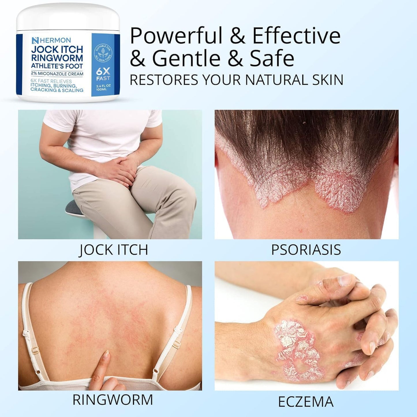 Hermon Jock Itch Antifungal Cream & Spray Set: Ringworm Treatment for Humans, Psoriasis Treatment, Psoriasis Scalp Treatment, Ringworm Cream for Humans, Foot & Body Balm, Provides Soothing Relief