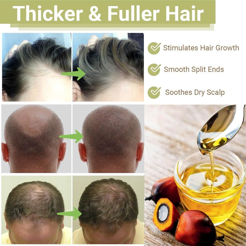 Batana Oil for Hair Growth - 100% Pure & Natural Unrefined Oil | Thicker, Stronger Hair - 2 FL OZ (60ml)