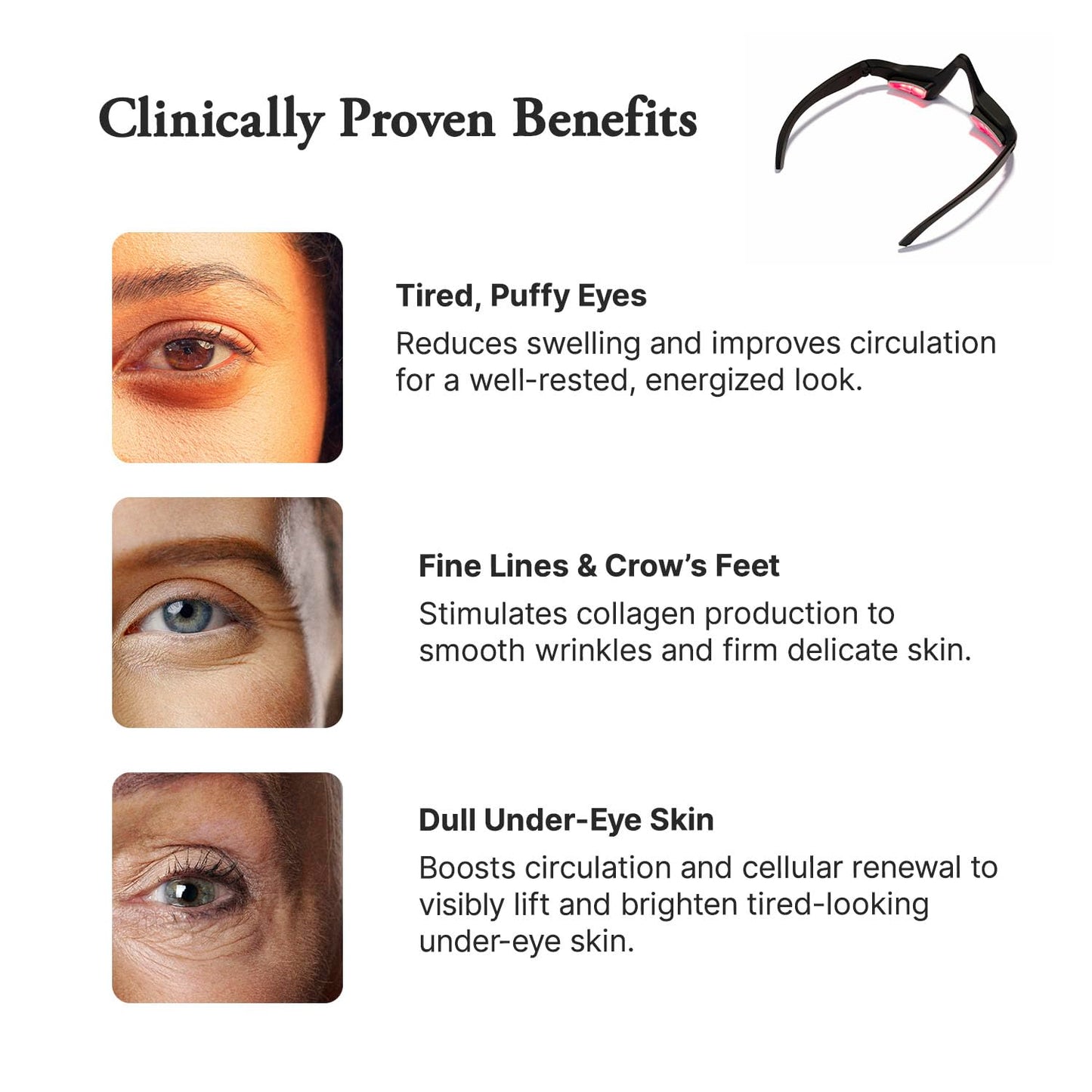 Capillus Eyelift Red Light Therapy Glasses - 685nm Treatment for Under Eye Bags, Wrinkles & Dark Circles
