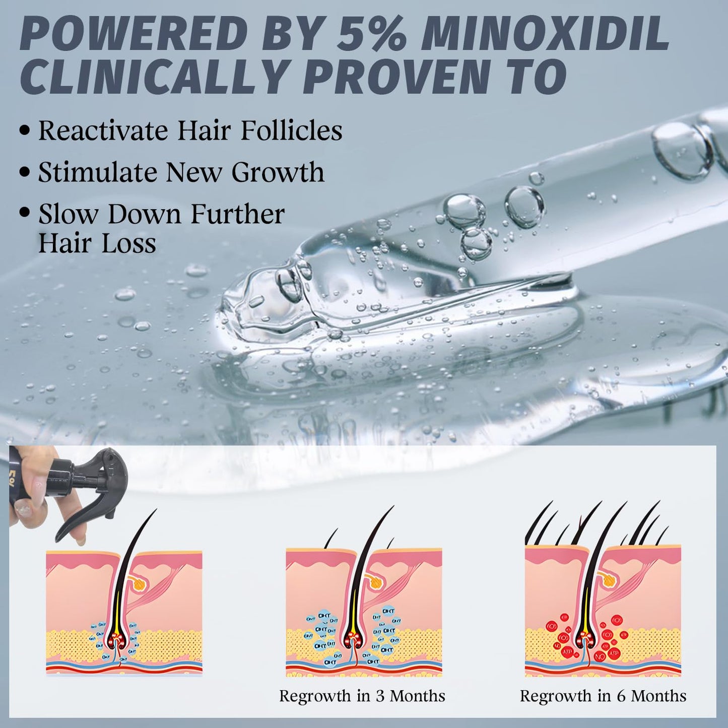 Minoxidil Spray for Hair Growth - Effective Treatment for Thinning Hair & Receding Hairline | 4 oz with Rosemary Extract