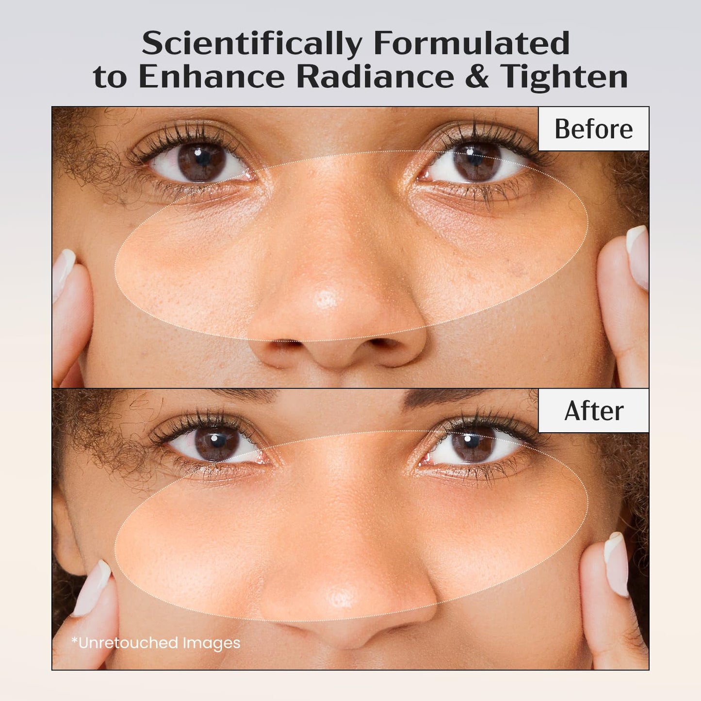 Lanmeri Ceuticals Vitamin C Serum - 15% Antioxidant Defense with Vitamin E & Ferulic Acid | 1 fl oz