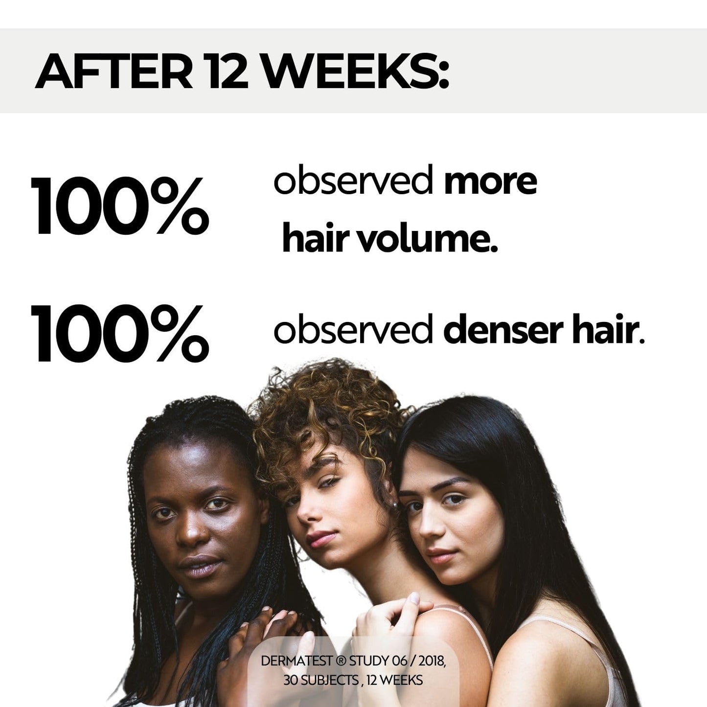 Ahuhu ESSENTIAL ANTI-AGE Elixir With Caffeine & Redensyl (100ml) - Highly Concentrated Scalp Care, Stimulates Hair Growth, Provides Thicker Hair & More Volume, Vegan