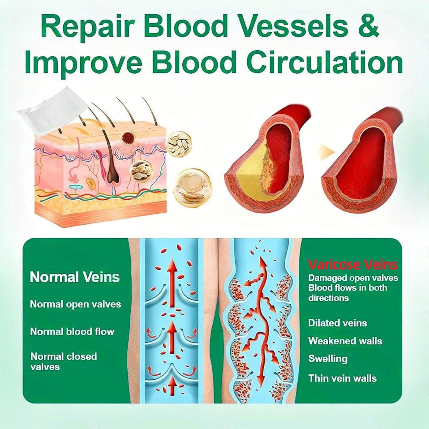 Healrize Vein Target Microdarts Patch - Natural Varicose Vein Treatment for All Skin Types | 2 Boxes