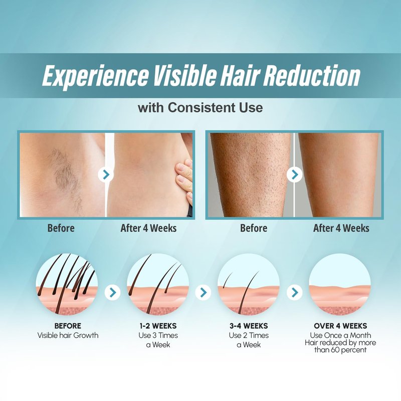 Herbishh At-Home Hair Reduction Handset with Cooling Care, Adjustable Intensity Levels, Dual Modes Auto & Manual, Quartz Tube Light-Based Personal Grooming Tool for Face & Body, White