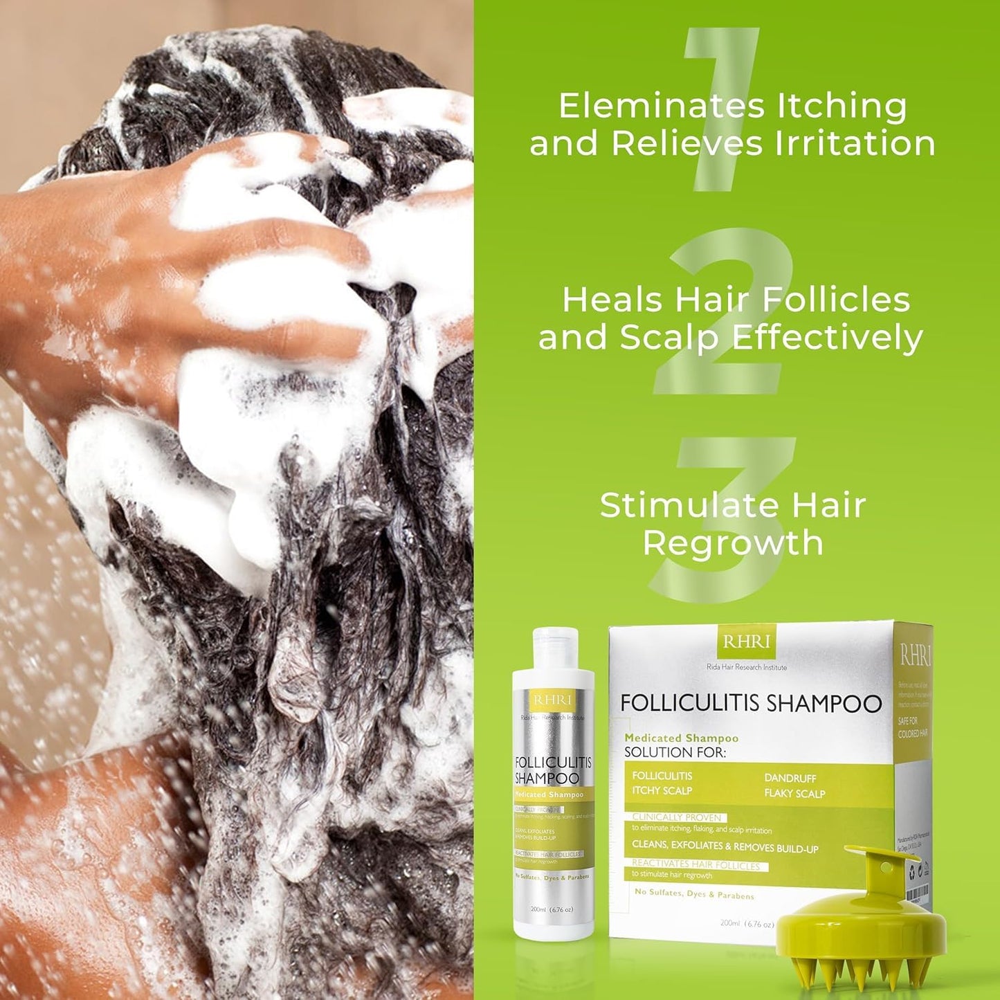 Folliculitis Shampoo - Antifungal Treatment for Seborrheic Dermatitis & Scalp Psoriasis | Soothes Itchy, Dry Scalp