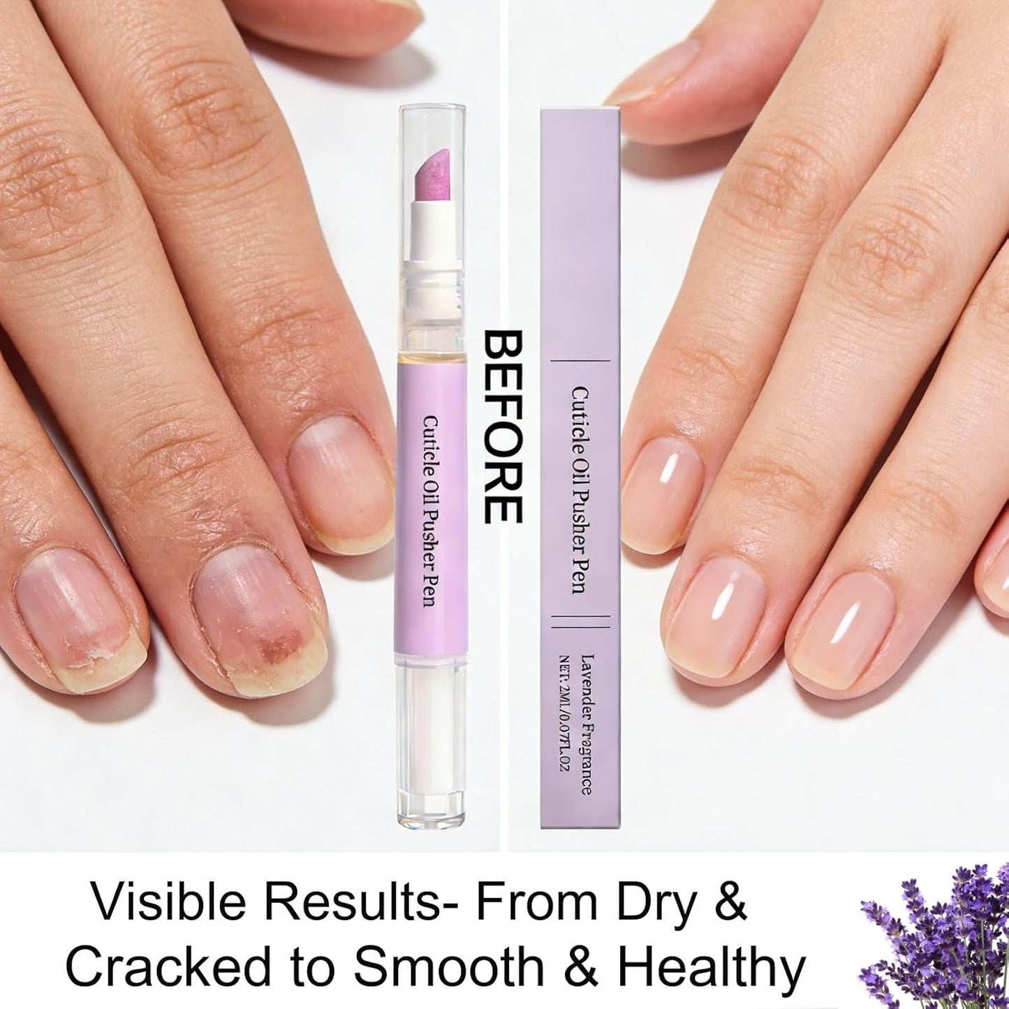 Cuticle Oil Pusher Pen Set - 2-in-1 Ceramic Tip Remover & Nail Oil | Portable Manicure Kit for Dry Nails