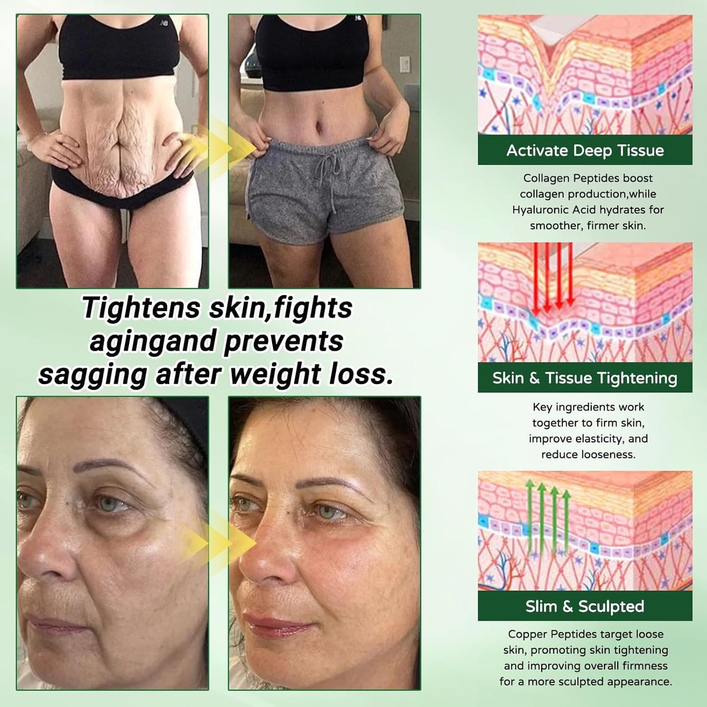 Moringa 10-In-1 Nano Microdarts Patch | Natural Slimming Patches for All Skin Types - 3 Boxes