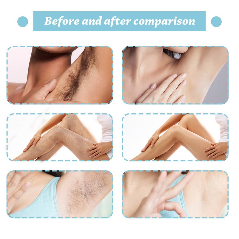 Hair Removal Cream for Women, Plant-Based Sensitive Skin Formula, Gentle and Effective Depilatory Formula for Legs, Arms, and Bikini Area (1)