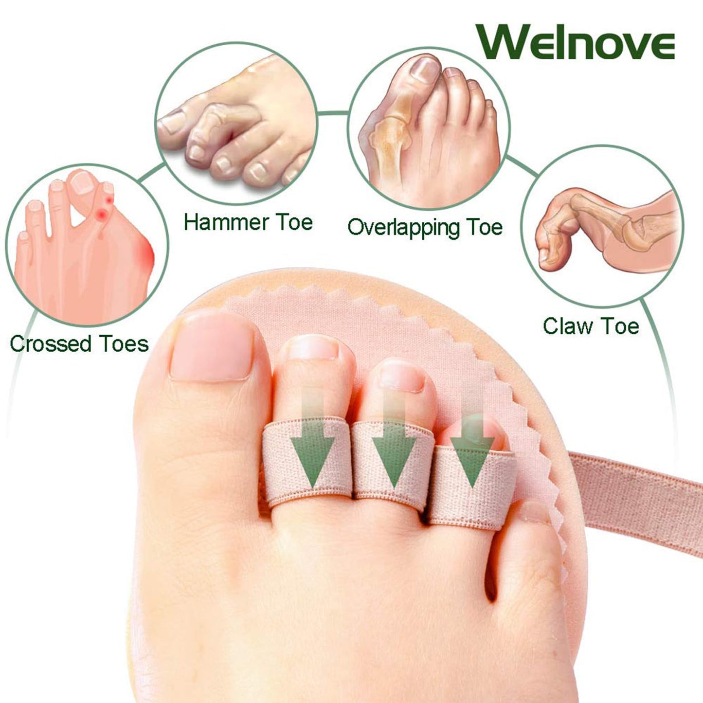 Welnove Toe Straightener Hammer Toes Corrector Pack of 2 (3 Holes) for Claw Toe Mallet Toe Contracted Toe and Cured Toe Hammer Toe Splint