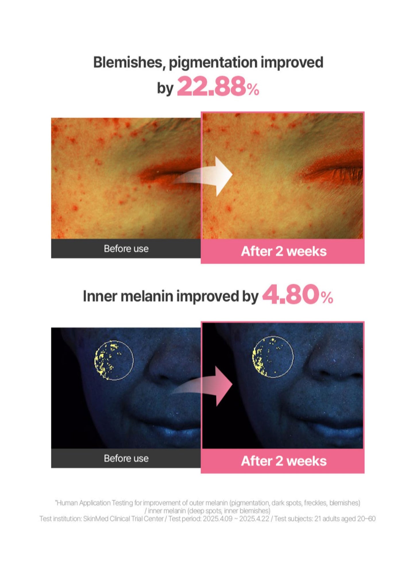 BeginS by JUNGSAEMMOOL Pink Guava Glutathione Blemish Cream 1.7 Fl Oz, Facial Moisturizer with 99% Pure Glutathione, Niacinamide and Vitamin C, Lightweight Hydration, Korean Skincare for Daily Use