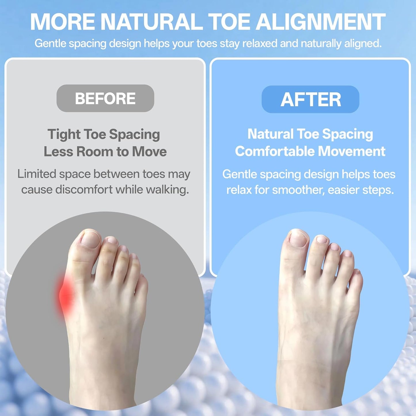 Toe Separators for Women & Men | Soft Silicone 6 Pairs for Bunion Relief & Toe Alignment