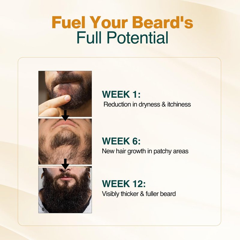 NOURISH MANTRA - Advanced Beard Growth Oil Serum | Made with Redensyl, Capilia Longa, Argan Oil, Vitamin E and Jojoba Oil for Fuller, Thicker & Healthier Beard Growth | Beard Oil Serum For Men | 30 ml