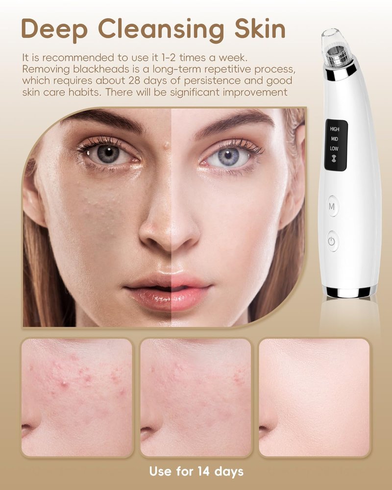 Pore Vacuum Blackhead Remover - Pore Extractor with 5 Attachments & 3 Suction Levels - Blackhead Remover Tools for Women and Men (White)