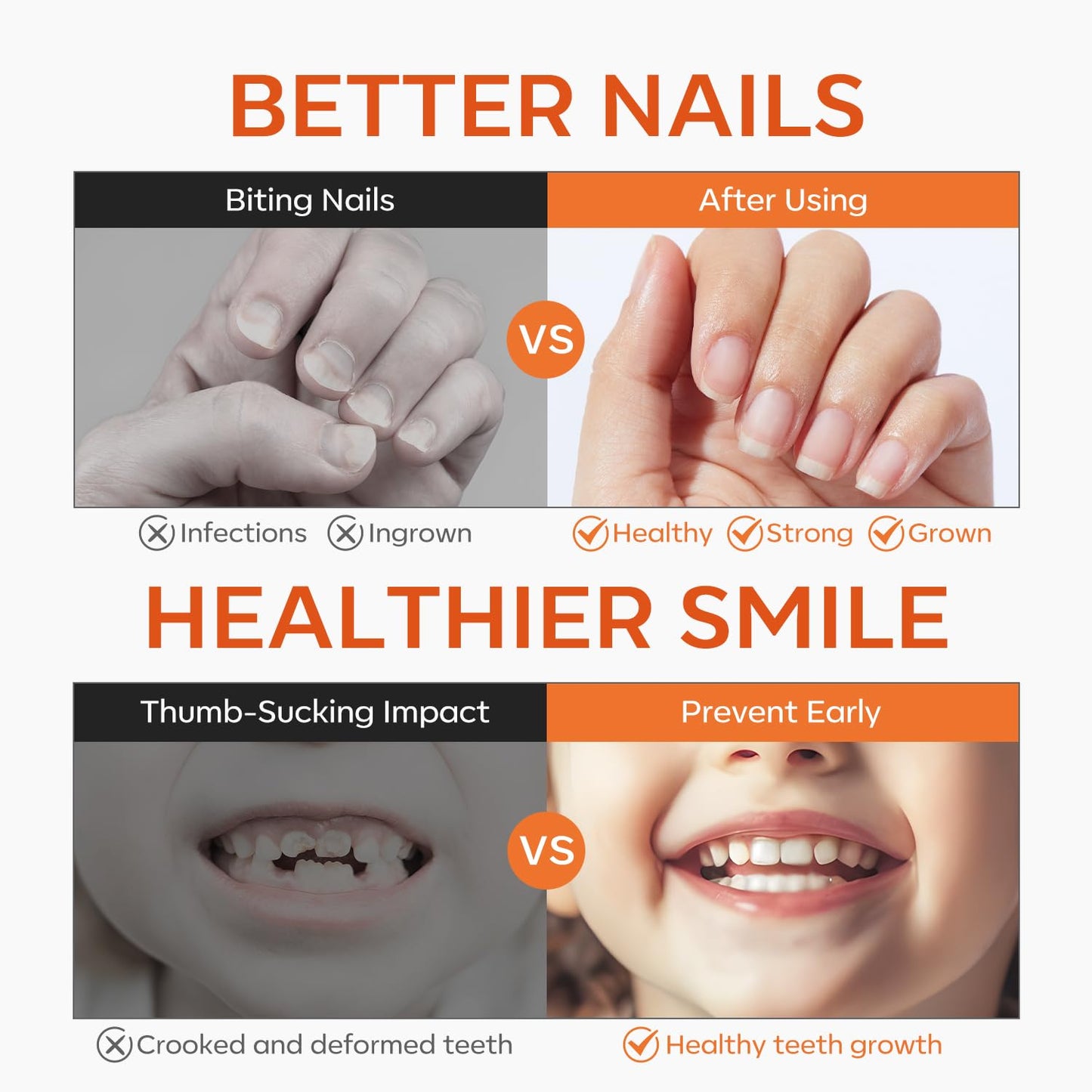 Modelones Nail Biting Prevention | Kids' Thumb Sucking Deterrent Bitter Nail Polish - 0.46 fl oz, Safe for Ages 1+