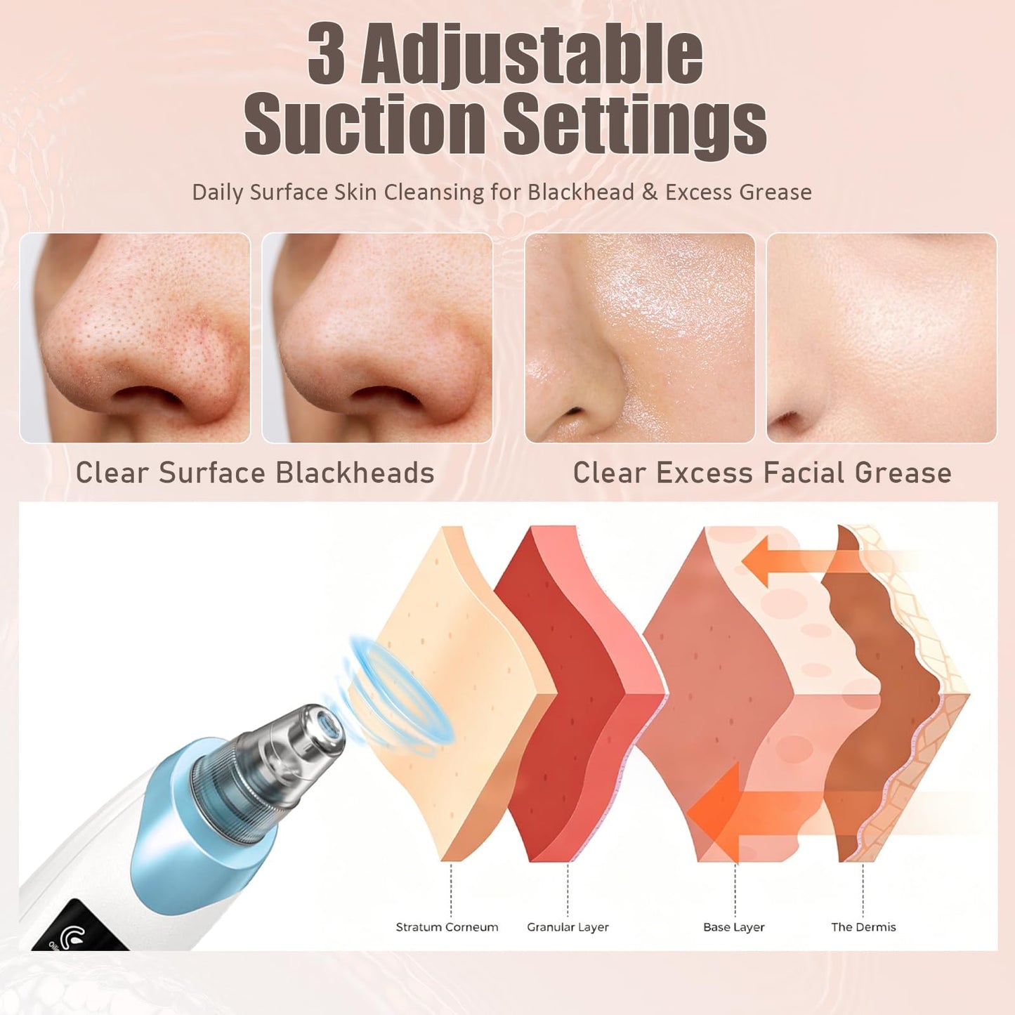 2026 Blackhead Remover Pore Vacuum,Facial Pore Cleaner-5 Suction Power,5 Probes,USB Rechargeable Blackhead Vacuum Kit Electric Pore Vacuum Tool for Adult