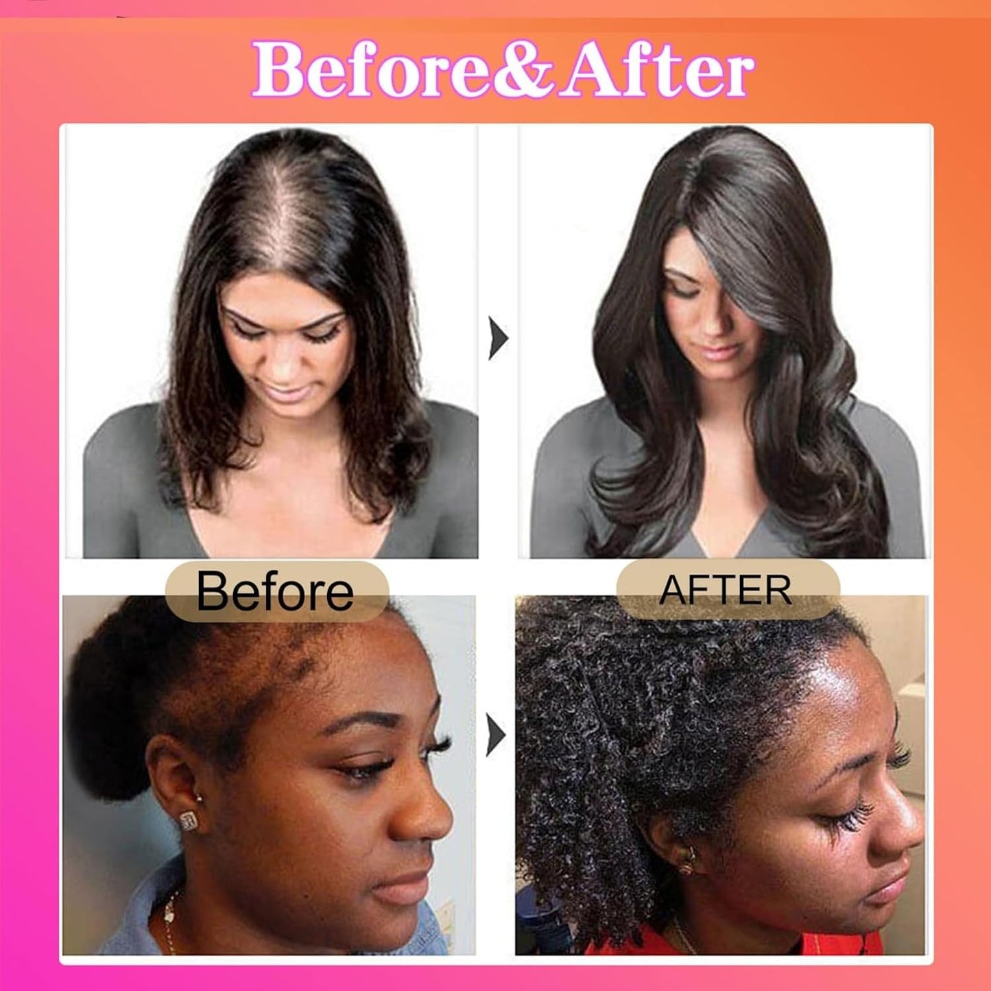 Batana Oil for Hair Growth - Organic Unrefined Hair Oil | Restores Damaged Hair & Scalp, 4.2 OZ